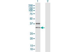 KIR2DS3 antibody  (AA 1-304)