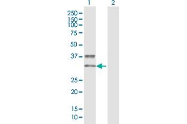 KIR2DS3 Antikörper  (AA 1-304)