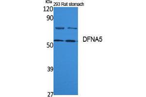 Western Blotting (WB) image for anti-Deafness, Autosomal Dominant 5 (DFNA5) (Internal Region) antibody (ABIN3187614) (DFNA5 antibody  (Internal Region))