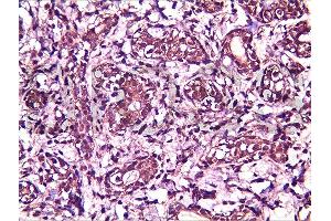 Immunohistochemistry (Paraffin-embedded Sections) (IHC (p)) image for anti-Breast Cancer Metastasis-Suppressor 1-Like (BRMS1L) (AA 151-246) antibody (ABIN730933)