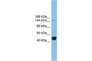 WB Suggested Anti-PRDM10 Antibody Titration: 0. (PRDM10 antibody  (Middle Region))