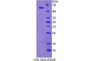 Image no. 1 for Nicastrin (NCSTN) (AA 35-534) protein (His tag) (ABIN4989454)