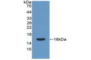 Detection of Recombinant CAT, Mouse using Polyclonal Antibody to Catalase (CAT) (Catalase antibody  (AA 32-157))