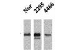 Image no. 1 for anti-Calcium/calmodulin-Dependent Protein Kinase II beta (CAMK2B) (pThr286), (Thr287) antibody (ABIN466897) (CAMK2B antibody  (pThr286, Thr287))