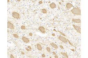 Immunohistochemistry analysis of paraffin-embedded mouse brain using MBP Polyclonal Antibody at dilution of 1:300. (MBP antibody)