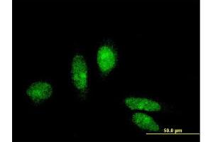 Immunofluorescence of monoclonal antibody to MTA3 on HeLa cell. (MTA3 antibody  (AA 416-515))