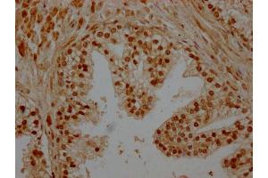 Immunohistochemistry (IHC) image for anti-SWI/SNF Related, Matrix Associated, Actin Dependent Regulator of Chromatin, Subfamily C, Member 2 (SMARCC2) (AA 300-647) antibody (ABIN7171053)