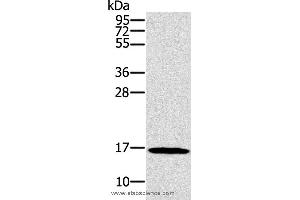 Western blot analysis of HT-29 cell, using SNCG Polyclonal Antibody at dilution of 1:800 (SNCG antibody)