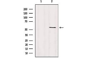 Western blot analysis of extracts from Hybridoma cells, using TMPRSS4 Antibody. (TMPRSS4 antibody  (Internal Region))