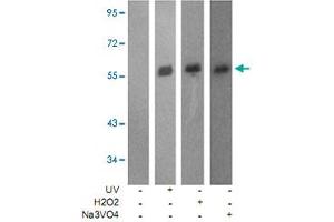 Western blot analysis of extracts from JK cells using LCK (phospho Y505) polyclonal antibody .