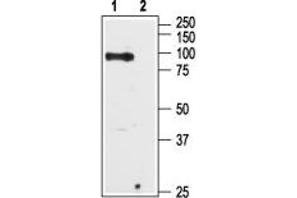 TRPV6 anticorps  (C-Term, Intracellular)