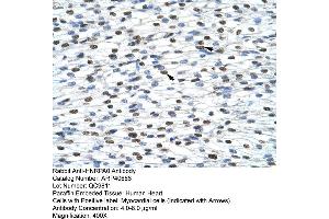 Rabbit Anti-HNRPA0 Antibody  Paraffin Embedded Tissue: Human Heart Cellular Data: Myocardial cells Antibody Concentration: 4.