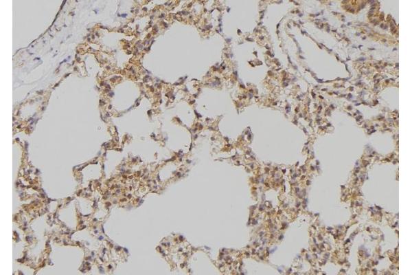 APOBEC3B antibody  (N-Term)