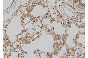 ABIN6275399 at 1/100 staining Rat lung tissue by IHC-P.