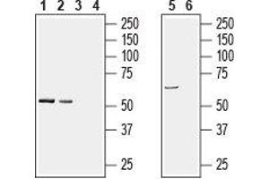 Western blot analysis of rat brain (lanes 1 and 3), mouse brain (lanes 2 and 4), (1:200) and human brain neuroblastoma SH-SY5Y cell line lysates (lanes 5 and 6), (1:600): - 1, 2, 5. (PACSIN1 antibody  (Intracellular))