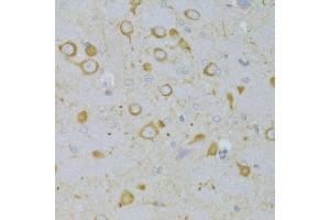 Immunohistochemistry of paraffin-embedded rat brain using TSHR Antibody. (TSH receptor antibody  (AA 21-253))