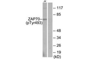 Western blot analysis of extracts from Jurkat cells, using ZAP-70 (Phospho-Tyr493) Antibody. (ZAP70 antibody  (pTyr493))
