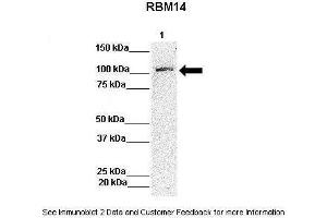 Lanes:   Lane 1: 50ug Hela Lysate  Primary Antibody Dilution:   1:1000  Secondary Antibody:   Anti-rabbit-HRP  Secondary Antibody Dilution:   1:10,000  Gene Name:   RBM14  Submitted by:   Archa Fox, University of Western Australia (RBM14 antibody  (N-Term))