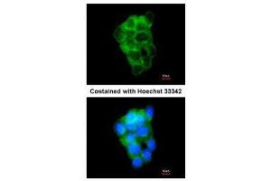 ICC/IF Image Immunofluorescence analysis of methanol-fixed A431, using PPFIBP2, antibody at 1:200 dilution. (PPFIBP2 antibody  (Center))