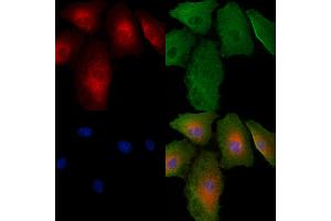 ABIN6264924 and ABIN6279466 staining  cells by IF/ICC. (SAR1A antibody  (Internal Region))