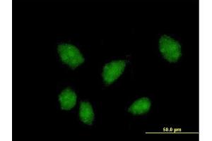 Immunofluorescence of purified MaxPab antibody to FKBPL on HeLa cell. (FKBPL antibody  (AA 1-349))