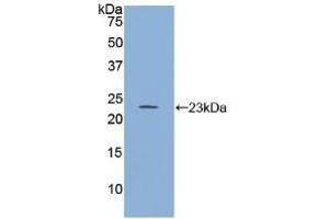 Detection of Recombinant RGS4, Human using Polyclonal Antibody to Regulator Of G Protein Signaling 4 (RGS4) (RGS4 antibody  (AA 38-205))
