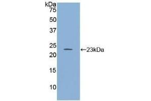 Detection of Recombinant RGS4, Human using Polyclonal Antibody to Regulator Of G Protein Signaling 4 (RGS4)