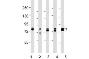 Western blot testing of DNM1L antibody at 1:8000 dilution and lysate from: 1: rat PC12; 2: human skeletal muscle; 3: HeLa; 4: mouse NIH3T3; 5: LNCaP; Predicted molecular weight is 82 kDa. (Dynamin 1-Like antibody  (C-Term))