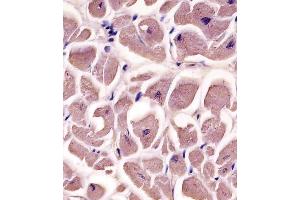 A staining MYBPC3 in human heart tissue sections by Immunohistochemistry (IHC-P - paraformaldehyde-fixed, paraffin-embedded sections). (MYBPC3 antibody  (N-Term))