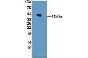 Detection of Recombinant CENTa2, Rat using Polyclonal Antibody to Centaurin Alpha 2 (CENTa2) (ADAP2 antibody  (AA 49-360))