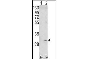 Western blot analysis of ITM2A (arrow) using rabbit polyclonal ITM2A Antibody (N-term) (ABIN390731 and ABIN2841002).