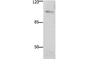 Western Blot analysis of Mouse brain tissue using FAK Polyclonal Antibody at dilution of 1:1850