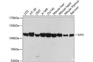Western blot analysis of extracts of various cell lines using GAA Polyclonal Antibody at dilution of 1:1000. (GAA antibody)