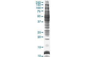 Image no. 1 for Mouse liver tissue lysate (non-denatured) (ABIN1339598)
