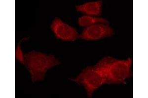 ABIN6277475 staining HUVEC by IF/ICC. (FSHR antibody  (Internal Region))