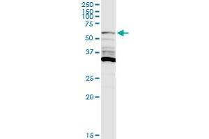 PIP5K1A MaxPab rabbit polyclonal antibody. (PIP5K1A antibody  (AA 1-500))