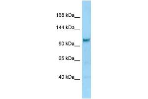 WB Suggested Anti-Diaph2 Antibody Titration: 1. (DIAPH2 antibody  (C-Term))