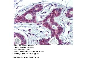 Immunohistochemistry with Human Breast tissue at an antibody concentration of 5. (FUBP1 antibody  (Middle Region))