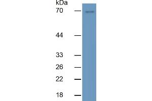 Rabbit Detection antibody from the kit in WB with Positive Control:  Sample Porcine liver lysate. (Selectin E/CD62e ELISA Kit)