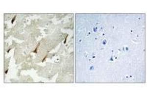 Immunohistochemistry analysis of paraffin-embedded human brain tissue using GPRIN2 antibody. (GPRIN2 antibody  (N-Term))