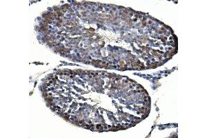 IHC analysis of Inhibin alpha/INHA using anti-Inhibin alpha/INHA antibody (ABIN7600932). (Inhibin alpha antibody  (AA 254-366))