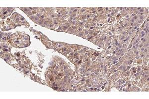 SLC4A7 antibody  (Internal Region)