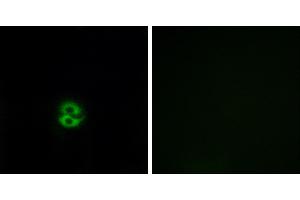 Peptide - +Immunofluorescence analysis of A549 cells, using CHST6 antibody. (CHST6 antibody)