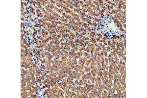 IHC analysis of ALDH1A3 using anti-ALDH1A3 antibody (ABIN5518802). (ALDH1A3 antibody  (AA 37-154))