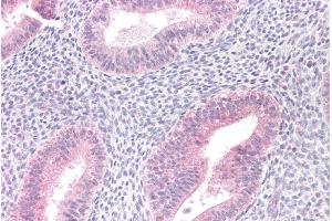 ABIN184636 (10µg/ml) staining of paraffin embedded Human Uterus. (MTM1 antibody  (C-Term))