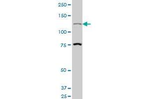 HIPK1 polyclonal antibody (A01), Lot # NIH82070326QCS1 Western Blot analysis of HIPK1 expression in Hela S3 NE . (HIPK1 antibody  (AA 330-430))