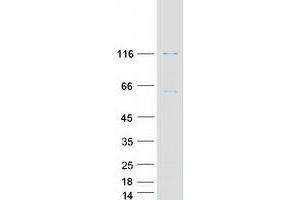 Validation with Western Blot (CARD14 Protein (Transcript Variant 1) (Myc-DYKDDDDK Tag))