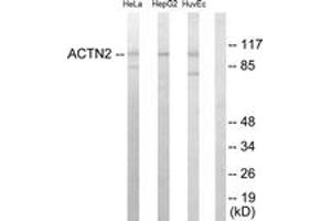 Western blot analysis of extracts from HepG2/HeLa/HuvEc cells, using Actinin alpha-2/3 Antibody. (ACTN2/3 antibody  (AA 31-80))