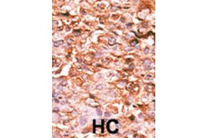 Immunohistochemistry (IHC) image for anti-HIST1H3B3 (pSer10) antibody (ABIN2933004) (HIST1H3B3 (pSer10) antibody)