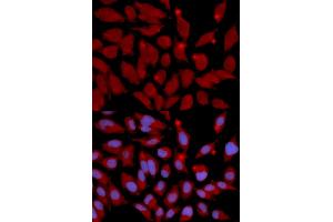 Immunofluorescence analysis of U2OS cells using DNMT3A antibody (ABIN5971096). (DNMT3A antibody)